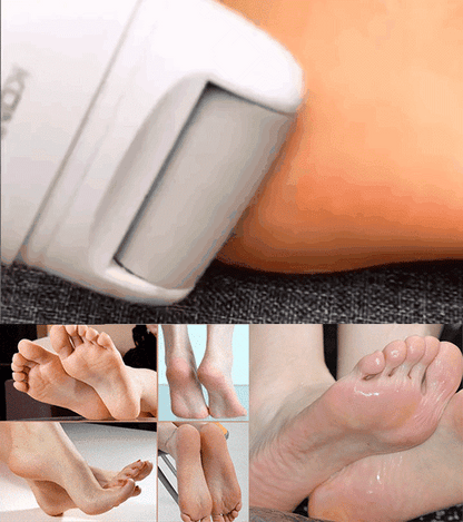 Rechargeable electric foot callus remover